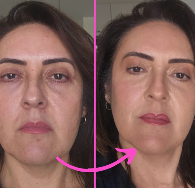 Antes e depois - mulher negra